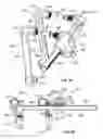 Fig. 40 - Minimally invasive spinal fixation system and related methods
