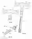 Fig. 44 - Minimally invasive spinal fixation system and related methods