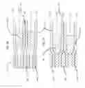 Fig. 08 - Systems and methods for intermedullary bone fixation