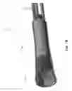Fig. 09 - Systems and methods for intermedullary bone fixation