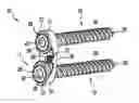 Fig. 01 - Lateral spine plate with set screw locking of bone screws