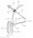 Fig. 01 - System and technique for accessing extra articular lesions or abnormalities or intra osseous lesions or bone marrow lesions