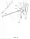 Fig. 28 - System and technique for accessing extra articular lesions or abnormalities or intra osseous lesions or bone marrow lesions