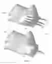 Fig. 12 - Finger controlled medical device interface