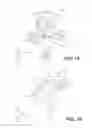 Fig. 10 - PATIENT REFERENCE ASSEMBLY FOR AN ELECTROMAGNETIC NAVIGATION SYSTEM