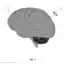 Fig. 02 - Patient reference tool for rapid registration