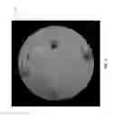 Fig. 19 - Patient reference tool for rapid registration
