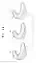 Fig. 09 - ORTHODONTIC TREATMENT METHOD USING AESTHETIC GUIDE LINE