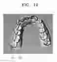Fig. 13 - ORTHODONTIC TREATMENT METHOD USING AESTHETIC GUIDE LINE