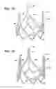 Fig. 23 - Durable high strength polymer composites suitable for implant and articles produced therefrom