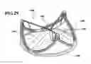 Fig. 31 - Durable high strength polymer composites suitable for implant and articles produced therefrom