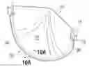 Fig. 01 - Heart valves with increased effective orifice area