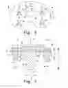 Fig. 04 - Prosthesis with surfaces having different textures and method of making the prosthesis