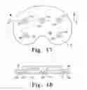 Fig. 10 - Prosthesis with surfaces having different textures and method of making the prosthesis