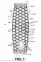 Fig. 02 - Bone implants for correcting bone defects