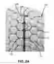 Fig. 04 - Bone implants for correcting bone defects