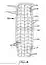 Fig. 05 - Bone implants for correcting bone defects