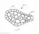Fig. 16 - Bone implants for correcting bone defects