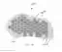 Fig. 17 - Bone implants for correcting bone defects