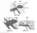 Fig. 27 - Bone implants for correcting bone defects