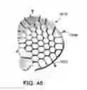 Fig. 30 - Bone implants for correcting bone defects
