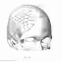 Fig. 31 - Bone implants for correcting bone defects