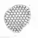 Fig. 37 - Bone implants for correcting bone defects