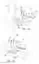 Fig. 06 - Elbow prosthesis