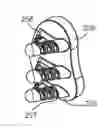 Fig. 01 - GLENOID ARTHROPLASTY