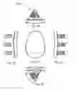 Fig. 04 - GLENOID ARTHROPLASTY