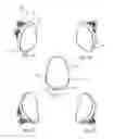 Fig. 09 - GLENOID ARTHROPLASTY