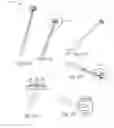Fig. 46 - GLENOID ARTHROPLASTY