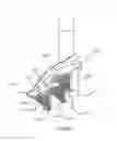 Fig. 48 - GLENOID ARTHROPLASTY