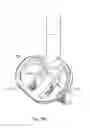 Fig. 49 - GLENOID ARTHROPLASTY
