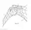 Fig. 50 - GLENOID ARTHROPLASTY