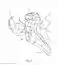 Fig. 52 - GLENOID ARTHROPLASTY