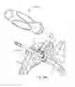 Fig. 55 - GLENOID ARTHROPLASTY