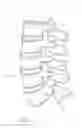 Fig. 02 - VERTEBRAL FACET JOINT PROSTHESIS AND METHOD OF FIXATION