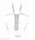 Fig. 28 - VERTEBRAL FACET JOINT PROSTHESIS AND METHOD OF FIXATION