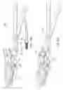 Fig. 18 - System and method for spine fusion using an expandable cage