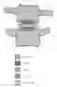 Fig. 01 - Fusion device