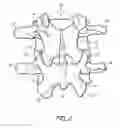 Fig. 03 - SYSTEM AND METHOD FOR PROTECTING NEUROVASCULAR STRUCTURES