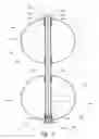Fig. 03 - Inflation devices for intragastric devices with improved attachment and detachment and associated systems and methods