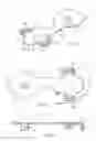 Fig. 02 - Ostomy pouch vent and method of venting an ostomy pouch