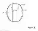 Fig. 07 - Heat exchanger cap