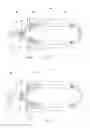 Fig. 05 - Cryogenic enhancement of joint function, alleviation of joint stiffness and/or alleviation of pain associated with osteoarthritis