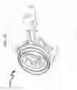 Fig. 104 - Ophthalmic laser treatment system and method