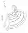 Fig. 113 - Ophthalmic laser treatment system and method