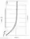 Fig. 33 - Ophthalmic laser treatment system and method