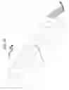 Fig. 57 - Ophthalmic laser treatment system and method